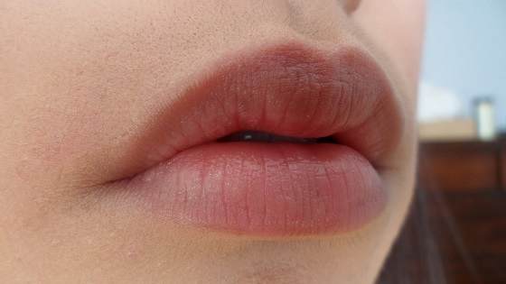 Black Lips to Pink Lips -10 natural Home Remedies