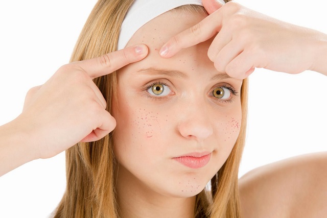 5 Powerful Ayurvedic Home Remedies for Acne Scars
